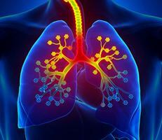 Asthma